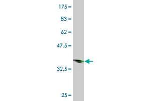 Western Blot detection against Immunogen (36. (HOXC13 anticorps  (AA 132-231))