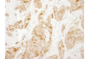 Immunohistochemistry (IHC) image for anti-Ribosomal Protein S6 (RPS6) (C-Term) antibody (ABIN7449016) (RPS6 anticorps  (C-Term))