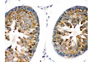 IHC analysis of TRPM5 using anti-TRPM5 antibody (ABIN3044566).