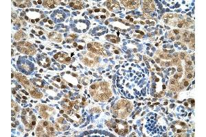 ZNF169 antibody was used for immunohistochemistry at a concentration of 4-8 ug/ml to stain Epithelial cells of renal tubule (arrows) in Human Kidney. (ZNF169 anticorps  (Middle Region))
