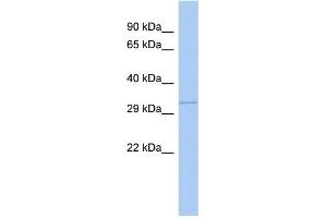 WB Suggested Anti-GNB1 Antibody Titration: 0. (GNB1 anticorps  (N-Term))