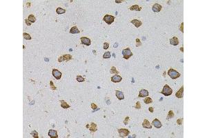Immunohistochemistry of paraffin-embedded Mouse brain using VEGFC Polyclonal Antibody (VEGFC anticorps)