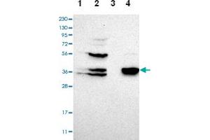 Western blot analysis of Lane 1: Human cell line RT-4, Lane 2: Human cell line U-251MG sp, Lane 3: Human plasma (IgG/HSA depleted), Lane 4: Human liver tissue with CGRRF1 polyclonal antibody  at 1:100-1:250 dilution. (CGR19 anticorps)