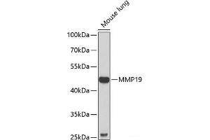 Western blot analysis of extracts of Mouse lung using MMP19 Polyclonal Antibody at dilution of 1:1000. (MMP19 anticorps)