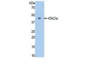 Detection of Recombinant ITGaM, Human using Polyclonal Antibody to Integrin Alpha M (CD11b) (CD11b anticorps  (AA 301-451))