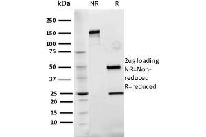 SDS-PAGE Analysis Purified Fibronectin Mouse Monoclonal Antibody (Fn-3). (Fibronectin 1 anticorps)