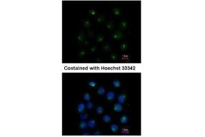 ICC/IF Image Immunofluorescence analysis of methanol-fixed A431, using SAR1A, antibody at 1:500 dilution. (SAR1A anticorps  (Center))