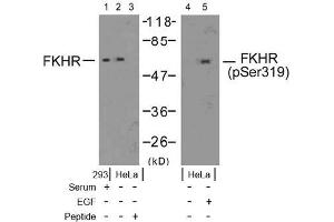 Image no. 2 for anti-Forkhead Box O1 (FOXO1) (pSer319) antibody (ABIN196849) (FOXO1 anticorps  (pSer319))
