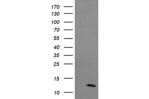 Image no. 1 for anti-D-Dopachrome Tautomerase (DDT) antibody (ABIN1497794) (DDT anticorps)