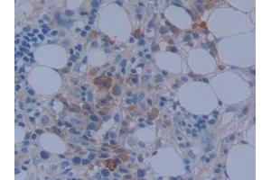 Used in DAB staining on fromalin fixed paraffin- embedded stomach tissue (MACC1 anticorps  (AA 522-784))