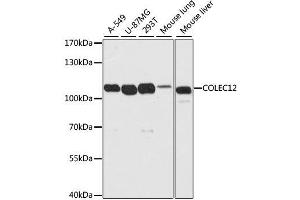 Western blot analysis of extracts of various cell lines, using COLEC12 antibody. (COLEC12 anticorps  (AA 60-270))