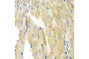 Immunohistochemistry of paraffin-embedded mouse heart using KRT19 antibody (ABIN5970077) at dilution of 1/100 (40x lens). (Cytokeratin 19 anticorps)