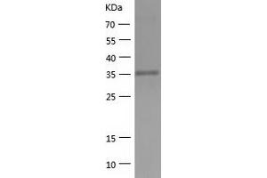 Western Blotting (WB) image for 3-hydroxyisobutyryl-CoA Hydrolase (HIBCH) (AA 33-386) protein (His tag) (ABIN7121612) (HIBCH Protein (AA 33-386) (His tag))