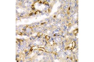 Immunohistochemistry of paraffin-embedded rat kidney using NEFL antibody. (NEFL anticorps)