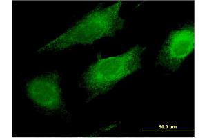 Immunofluorescence of monoclonal antibody to FAIM2 on HeLa cell. (FAIM2 anticorps  (AA 1-316))