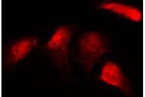 ABIN6269311 staining HepG2 by IF/ICC.