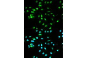 Immunofluorescence analysis of MCF7 cell using PAX3 antibody. (Paired Box 3 anticorps  (AA 1-206))