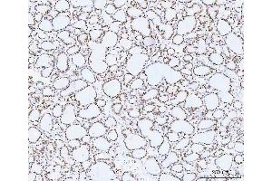 IHC analysis of HMGN2 using anti-HMGN2 antibody (ABIN6719576).