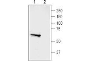 Western blot analysis of rat dorsal root ganglion (DRG) lysate: - 1. (ASIC3 anticorps  (Intracellular, N-Term))