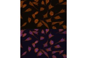 Immunofluorescence analysis of L929 cells using 43711 antibody (ABIN7270204) at dilution of 1:100.