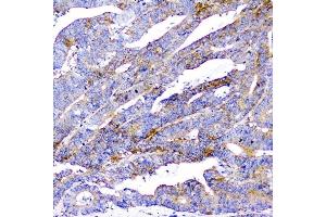 IHC analysis of CD2AP using anti-CD2AP antibody (ABIN6719544). (CD2AP anticorps  (AA 253-337))