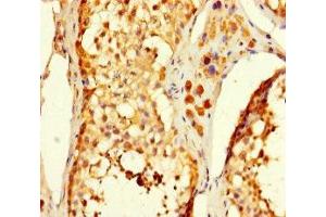 Immunohistochemistry of paraffin-embedded human testis tissue using ABIN7175061 at dilution of 1:100 (C5orf51 anticorps  (AA 8-152))