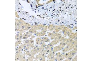 Immunohistochemistry of paraffin-embedded human liver injury using LETMD1 antibody at dilution of 1:100 (x40 lens). (LETMD1 anticorps)