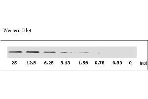 Image no. 3 for Epidermal Growth Factor Receptor (EGFR) ELISA Kit (ABIN625224) (EGFR Kit ELISA)