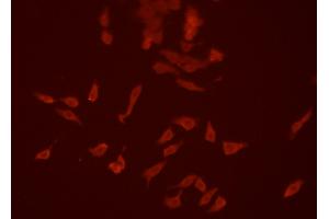 ABIN6266634 staining HEPG2 cells by ICC/IF. (SIRPA anticorps  (C-Term))