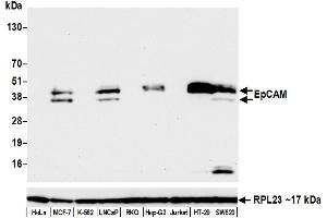 Western Blotting (WB) image for anti-Epithelial Cell Adhesion Molecule (EPCAM) (AA 264-314) antibody (ABIN7454025) (Recombinant EpCAM anticorps  (AA 264-314))