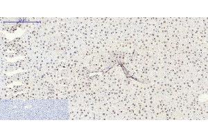 Immunohistochemistry of paraffin-embedded Rat liver tissue using SIRT1 Polyclonal Antibody at dilution of 1:200. (SIRT1 anticorps)