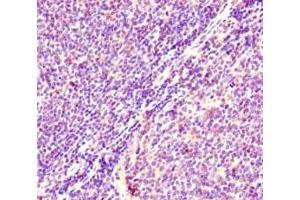 Immunohistochemistry of paraffin-embedded human lymphoid tissue using ABIN7178885 at dilution of 1:100 (HRAS anticorps  (AA 2-186))
