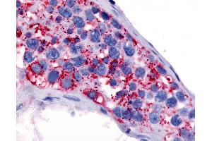 Anti-5HT1E Receptor antibody IHC of human testis.