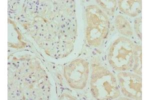 anti-Cartilage Associated Protein (CRTAP) (AA 20-240) antibody