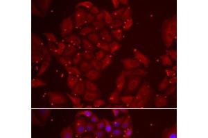 Immunofluorescence analysis of U2OS cells using TPP2 Polyclonal Antibody (Tpp2 anticorps)