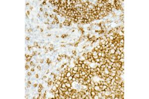 Immunohistochemistry of paraffin-embedded Human tonsil using CD19 antibody (ABIN7266169) at dilution of 1:10000 (40x lens).