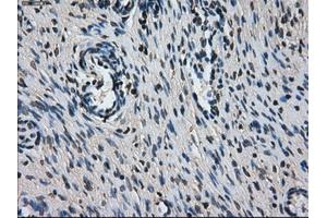 Immunohistochemical staining of paraffin-embedded colon tissue using anti-L1CAMmouse monoclonal antibody. (L1CAM anticorps)