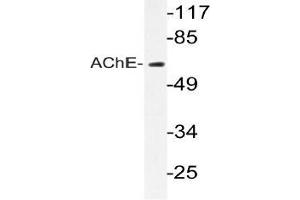 Western blot (WB) analyzes of AChE antibody in extracts from Jurkat cells. (Acetylcholinesterase anticorps)