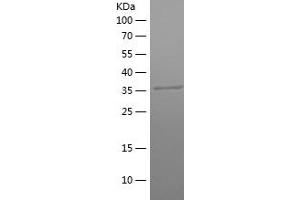 Western Blotting (WB) image for Phosphoglycerate Kinase 1 (PGK1) (AA 307-417) protein (His-IF2DI Tag) (ABIN7124415)