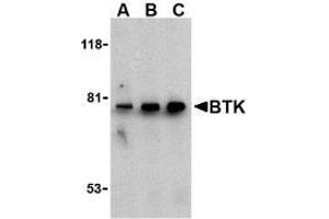 Western blot analysis of BTK in U937 cell lysate with AP30170PU-N BTK antibody at (A) 0. (BTK anticorps  (N-Term))