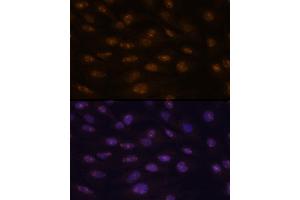 Immunofluorescence analysis of C6 cells using MyoD1 antibody  at dilution of 1:100. (MYOD1 anticorps  (AA 150-250))