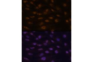 Immunofluorescence analysis of C6 cells using MyoD1 antibody  at dilution of 1:100.