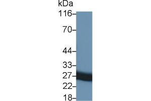 Detection of TIMP1 in Rat Seminal vesicle lysate using Monoclonal Antibody to Tissue Inhibitors Of Metalloproteinase 1 (TIMP1) (TIMP1 anticorps  (AA 25-207))