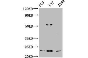 Western Blot Positive WB detected in: PC-3 whole cell lysate, U87 whole cell lysate, A549 whole cell lysate All lanes: FKBP11 antibody at 1:2000 Secondary Goat polyclonal to rabbit IgG at 1/50000 dilution Predicted band size: 23, 16 kDa Observed band size: 23 kDa (FKBP11 anticorps  (AA 28-154))