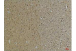 Immunohistochemical analysis of paraffin-embedded Rat BrainTissue using KCNK4 (TRAAK) Rabbit pAb diluted at 1:200.