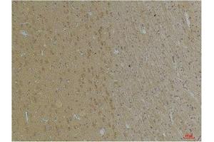 Immunohistochemical analysis of paraffin-embedded Rat BrainTissue using KCNK4 (TRAAK) Rabbit pAb diluted at 1:200. (KCNK4 anticorps)