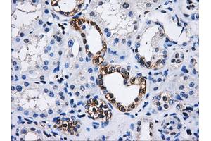 Immunohistochemical staining of paraffin-embedded Kidney tissue using anti-PPME1mouse monoclonal antibody. (PPME1 anticorps)