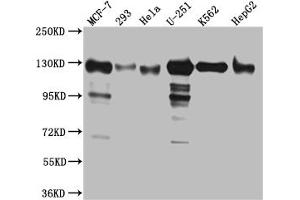 Western Blot Positive WB detected in: MCF-7 whole cell lysate, 293 whole cell lysate, Hela whole cell lysate, U-251 whole cell lysate, K562 whole cell lysate, HepG2 whole cell lysat All lanes: Eg5 Antibody at 1:1000 Secondary Goat polyclonal to rabbit IgG at 1/50000 dilution Predicted band size: 120 kDa Observed band size: 130 kDa (Recombinant KIF11 anticorps)