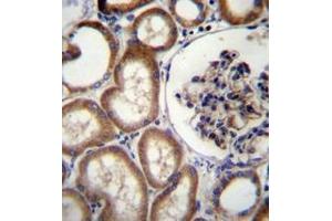 Immunohistochemistry analysis in formalin fixed and paraffin embedded human kidney tissue reacted with MBTPS2 Antibody (N-term) followed which  peroxidase conjugated to the secondary antibody and was followed by AB staining. (MBTPS2 anticorps  (N-Term))
