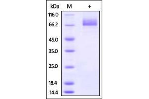 Influenza A [A/Hong Kong/483/97 (H5N1)] HA on SDS-PAGE under reducing (R) condition.